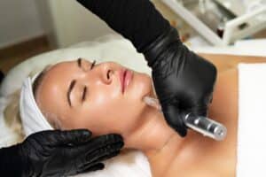 Cosmetologist performing microneedling with PRF for facial rejuvenation, combining advanced technology and natural growth factors to improve skin texture and elasticity.